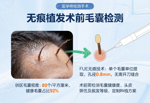 重庆无痕植发价格大起底