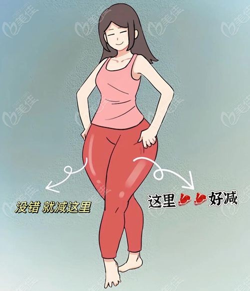 连云港大腿吸脂医院哪家好