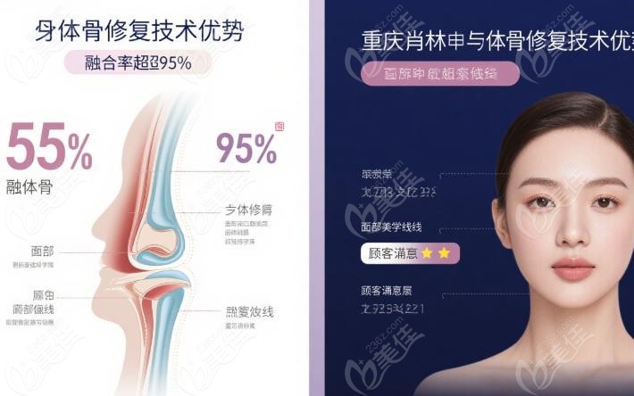重庆肖林自体骨修复：核心技术揭秘，复杂缺损的重建