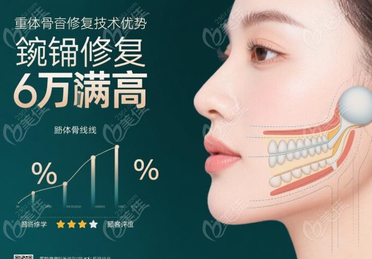 重庆肖林自体骨修复：术中安心，与美学并重
