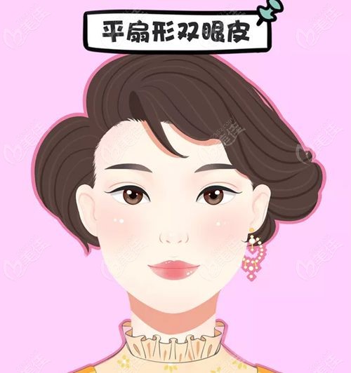 冯思阳双眼皮修复真实实例