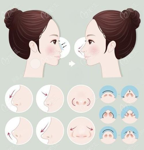 南京康美整形医院冯思阳成功实例大公开