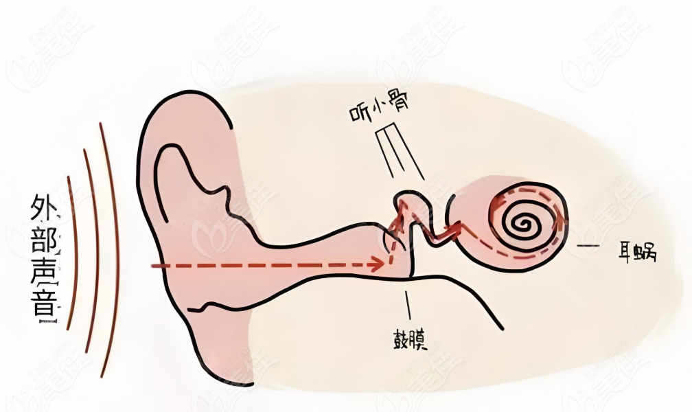 八大处耳再造手术的 费用参考