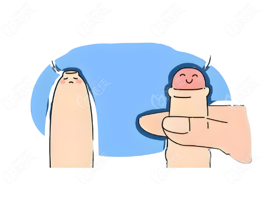 阴茎延长增粗