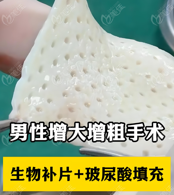 李世荣生殖器整形患者实例