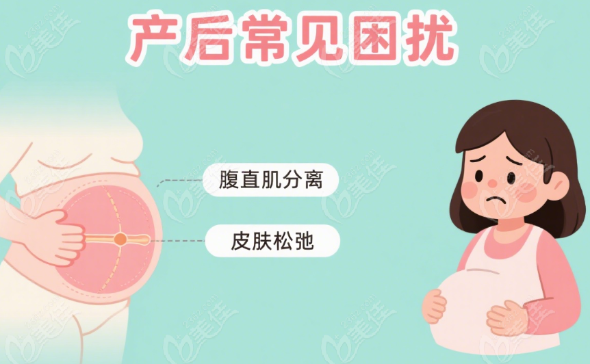 生完孩子肚子松垮？宝妈别慌！这 3 个原因让你明白为啥瘦不回去