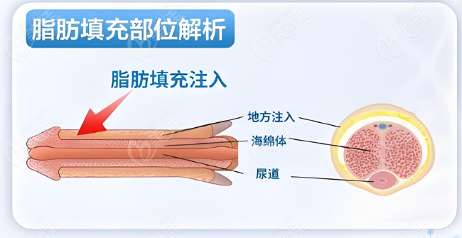 李世荣手术实例常见问题深度解答