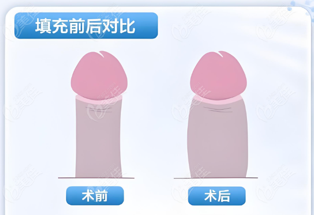 为什么李世荣手术实例值得学习与选择