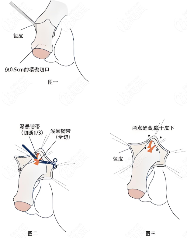 李世荣在男性私密整形领域堪称行业领头羊