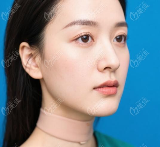 馬梅生面部吸脂多少錢(qián)啊