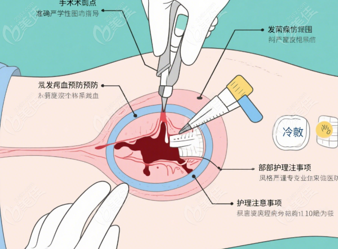 适合体验面部筋膜拉皮提升