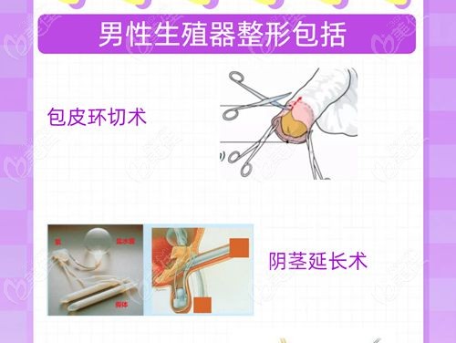 男性生殖整形医生吕巍靠谱