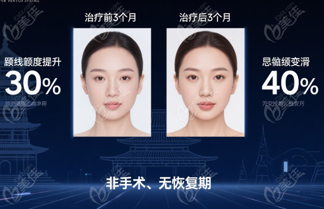 西安画美半岛超声炮设备的真假