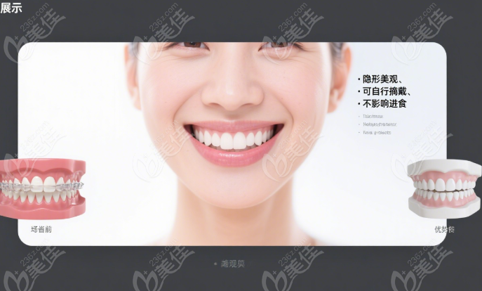 隐形牙套临床疗效差异