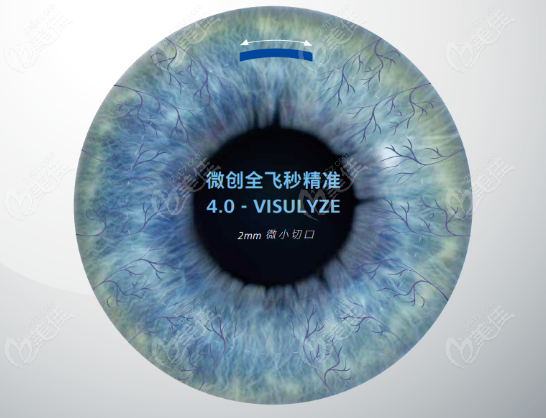 徐州瑞博医院眼科蔡司全飞秒3.0&4.0核心对比