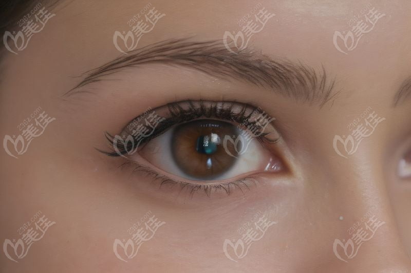 北京同仁醫(yī)院后鞏膜加固術(shù)哪位醫(yī)生好？段安麗醫(yī)生團隊的優(yōu)勢