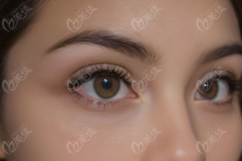 五、贵阳美目眼科医院:童趣化诊室+护理包,低龄孩子的“友好机构”