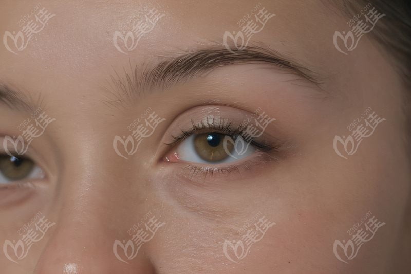 十、贵阳欧普康视眼科诊所:高端定制+终身维护,追求品质的家庭优选