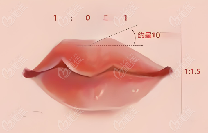 兔唇唇腭裂手术如何选择合适医院www.236z.com