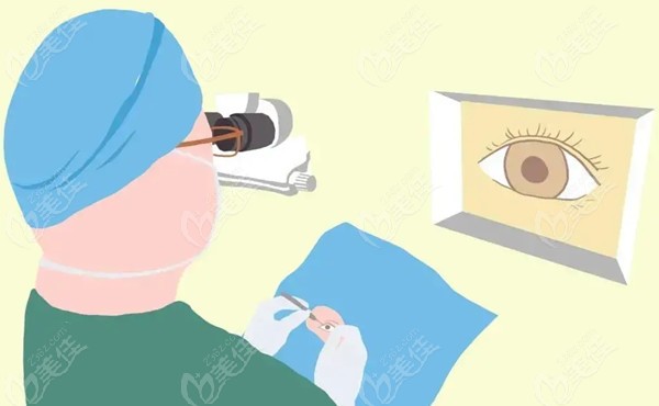 昆明艾维眼科近视手术医生详解