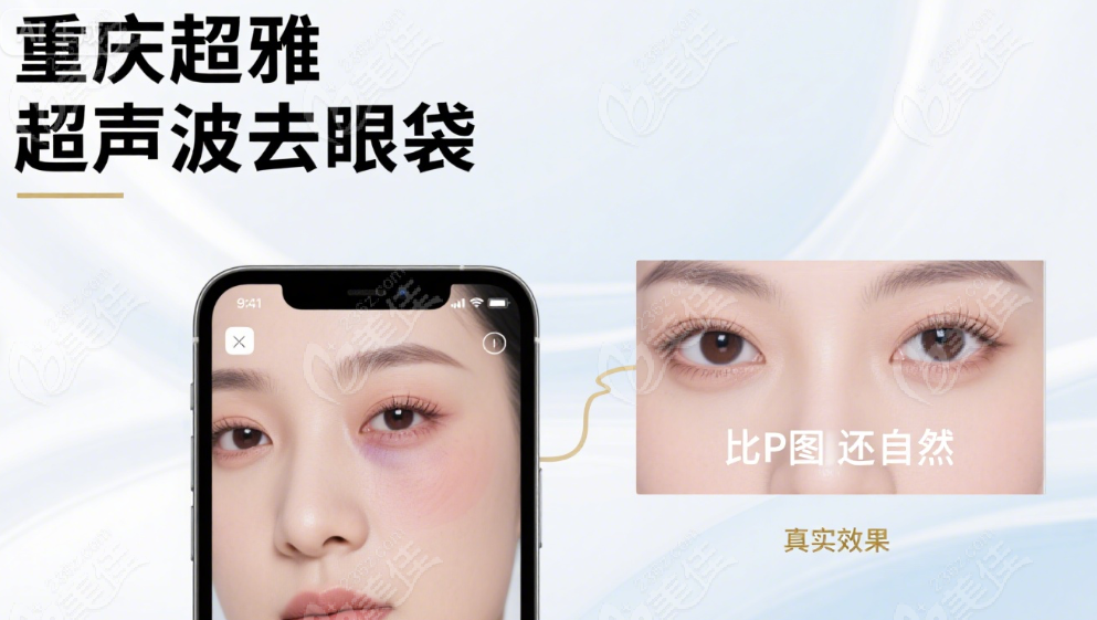 重庆超雅超声波去眼袋不骗人