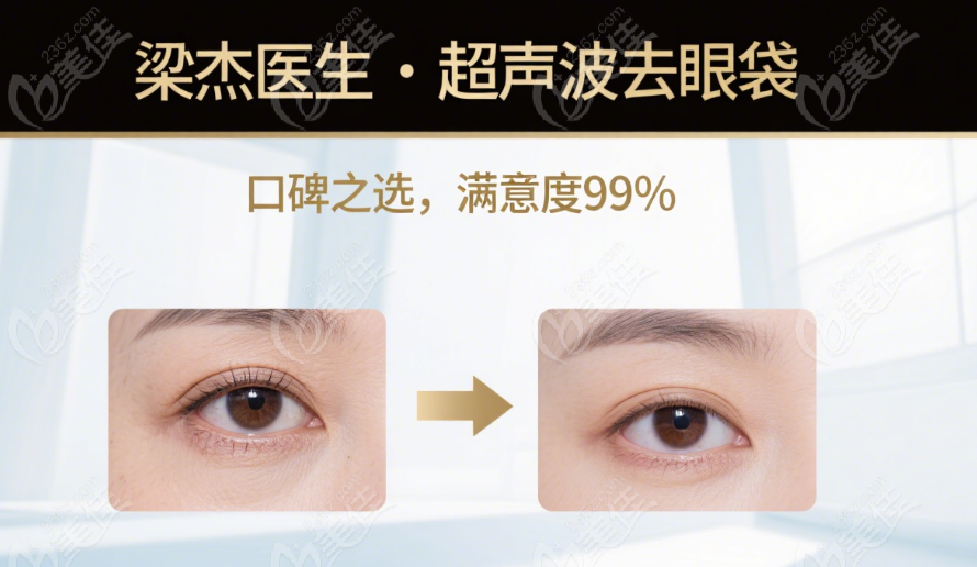 重庆超雅梁杰联系方式