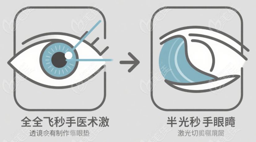 主流手術(shù)對比