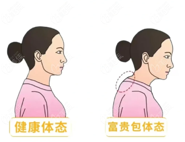 沈陽做富貴包多少錢的關(guān)鍵因素