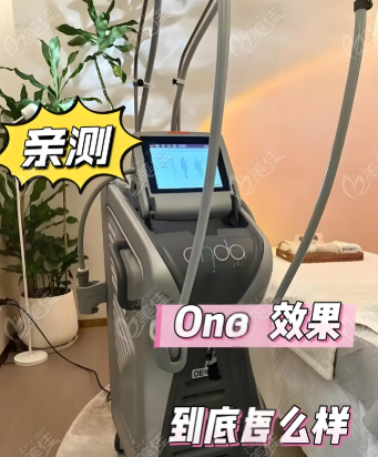 onda和热玛吉的区别