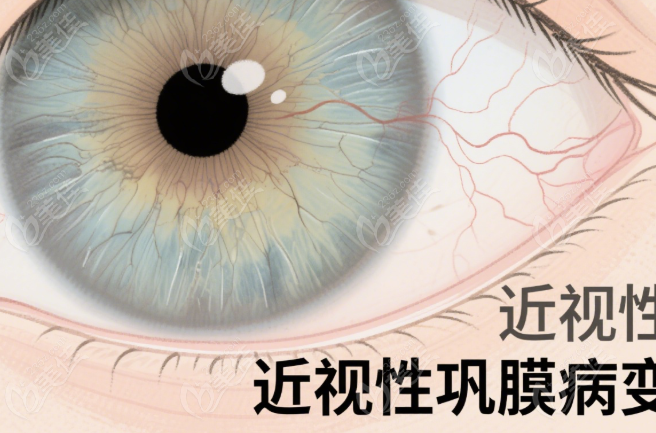 合肥后鞏膜加固術(shù)醫(yī)院哪家好236z.com