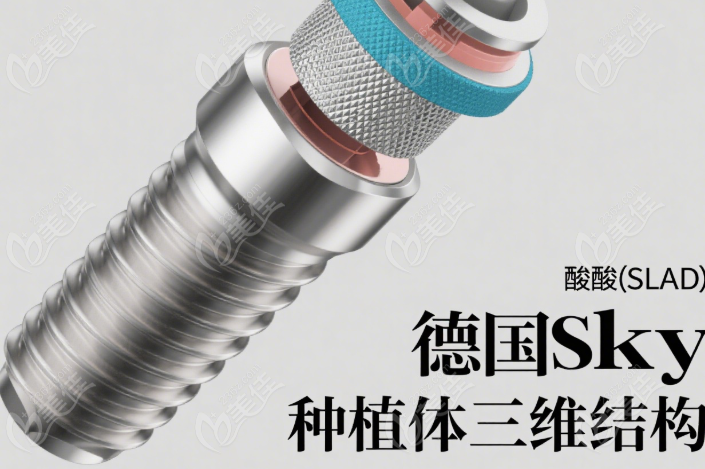 德国sky种植体中文名字236z.com