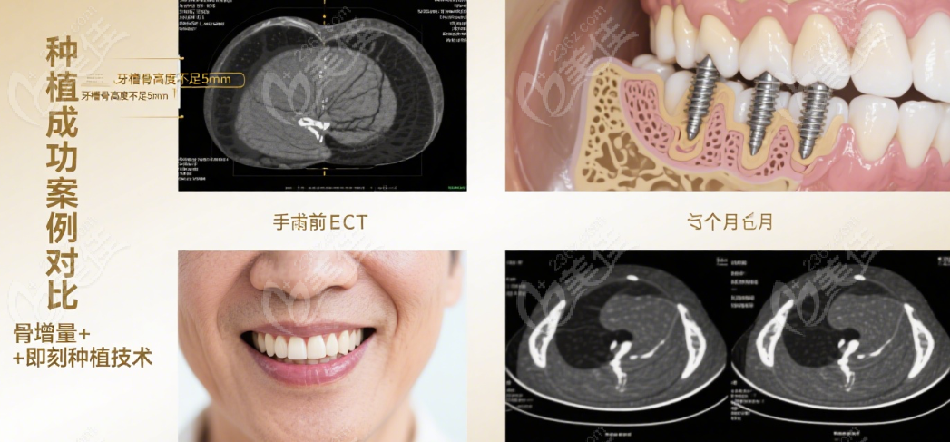 雅洁口腔为什么是中高端