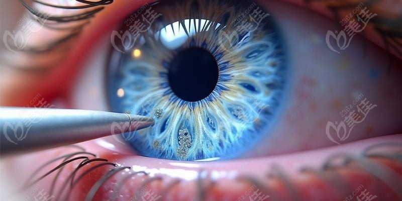 二、張家口四院眼科激光手術(shù)收費影響因素