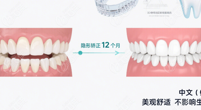 东兴牙齿矫正项目价格