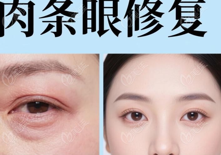 关于“初眼修复9800元起” 关于“初眼修复9800元起”