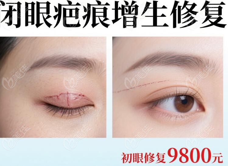 选张颖修复前,必须想清楚的修复前 选张颖修复前,必须想清楚的修复前