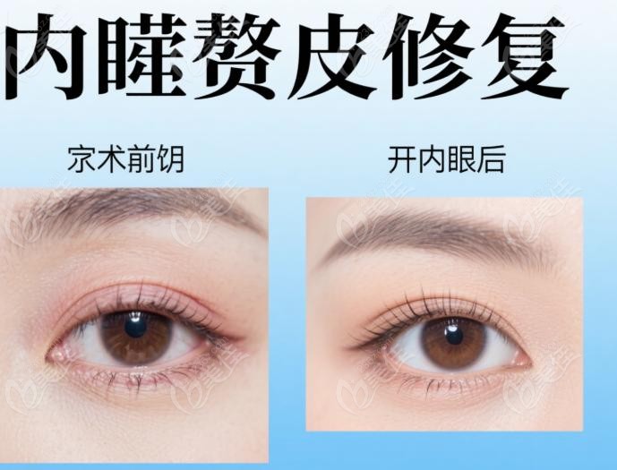 为啥说张颖做复杂初眼“更拿手”