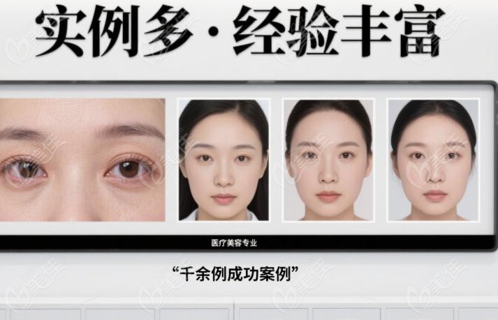 北醫(yī)三院做眼袋真人實例