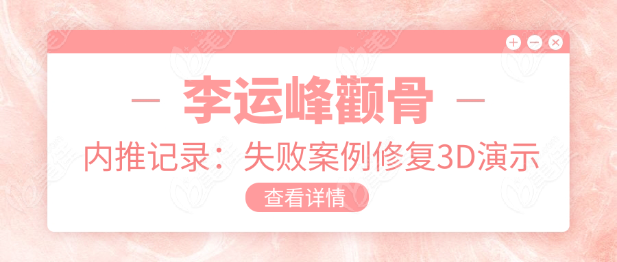 李運(yùn)峰顴骨內(nèi)推記錄：失敗修復(fù)3D演示全過程