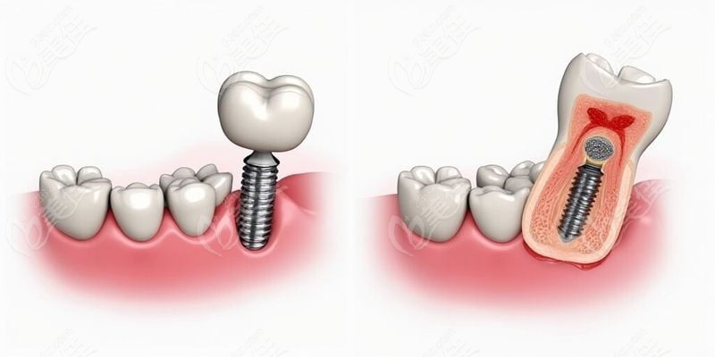 榆次萊特口腔補(bǔ)牙技術(shù)有何特色？