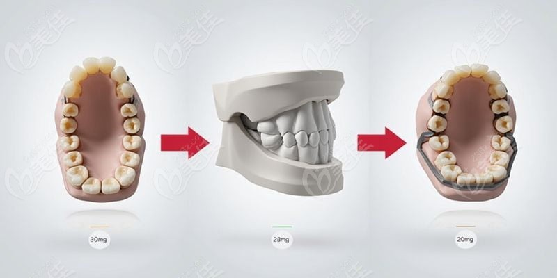 榆次萊特口腔補(bǔ)牙患者真實(shí)評(píng)價(jià)