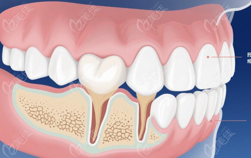 为什么这个这么成功？技术+经验+细心