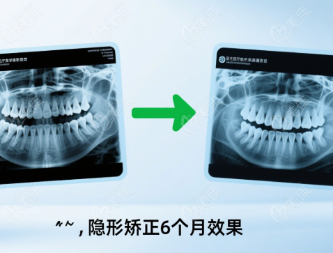 蘭州康美齒科做牙齒矯正靠譜嗎236z.com