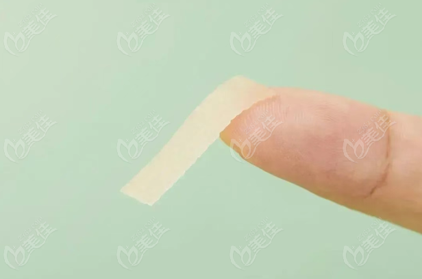 遼寧曙光整形外科醫(yī)院去疤痕優(yōu)勢(shì)
