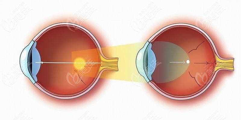 中山大学中山眼科中心区庄院区就诊流程是怎样的？