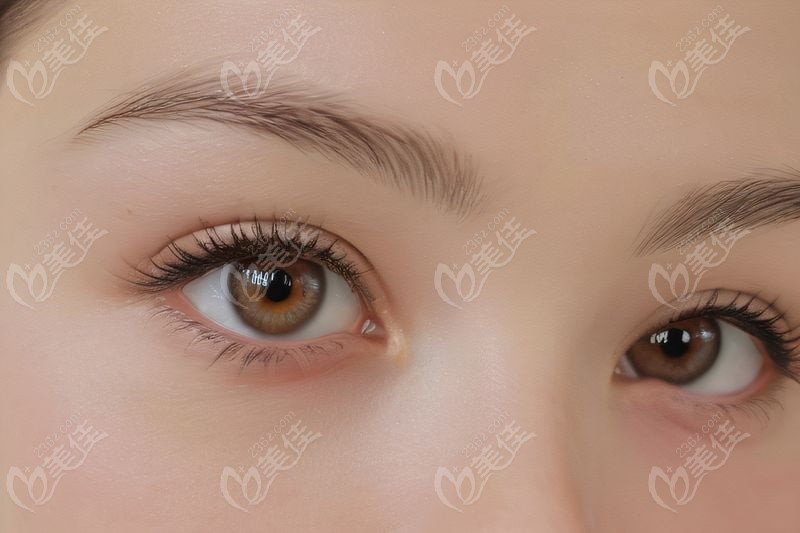 三、北海近視手術(shù)價(jià)格一覽表醫(yī)院推薦www.pfflawyer.com