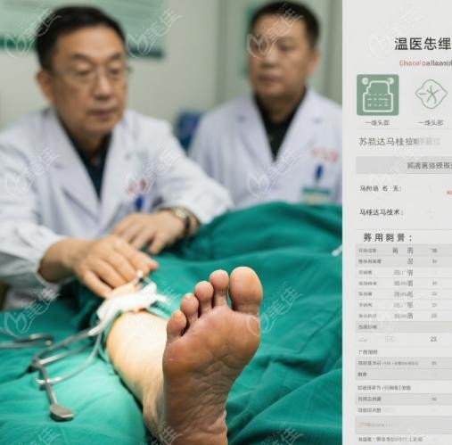 温建民与苏敬达、马桂文拇外翻手术的技术对比