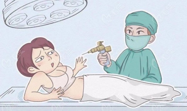 许扬滨隆胸正规