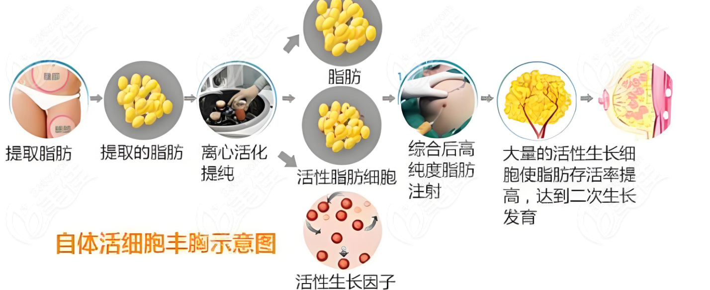 李春财体雕项目示意图