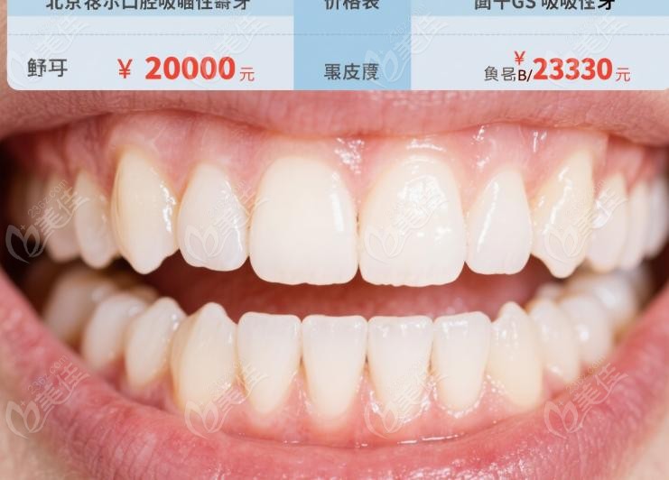 北京科尔口腔吸附性义齿价格表